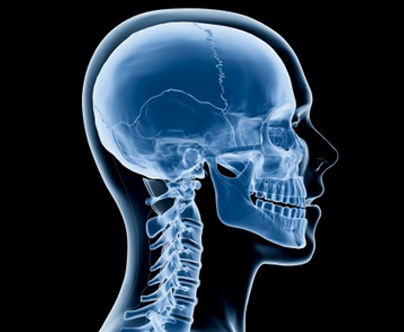 procedimentos-neurocirurgia-cranio-2